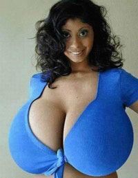 breastimplants